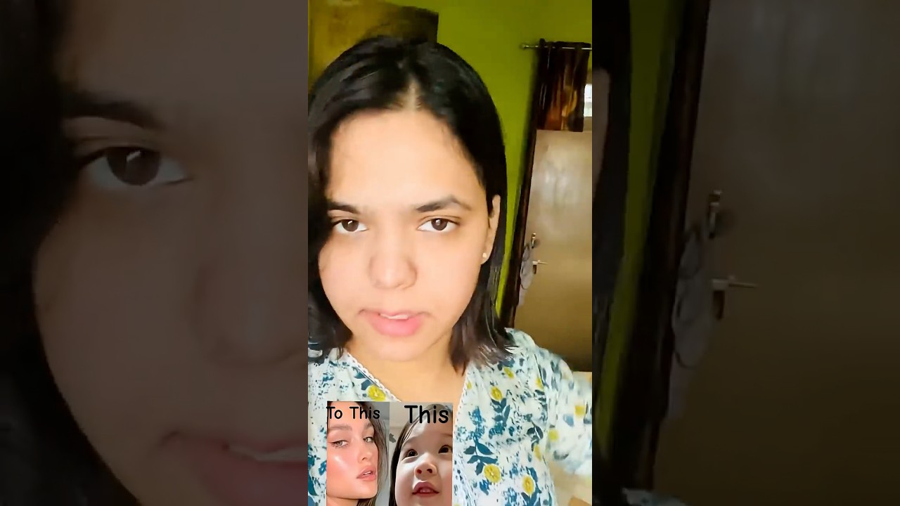 Baby Face Problems 👴