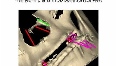 new triple scan protocol Dr  Gross