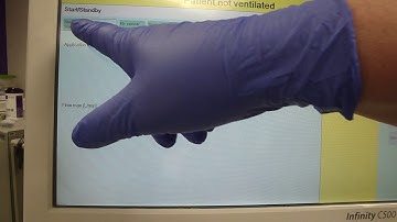 Extubating an Infant to NIV/NIPPV