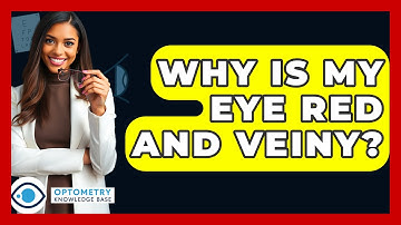 Why Is My Eye Red And Veiny? - Optometry Knowledge Base