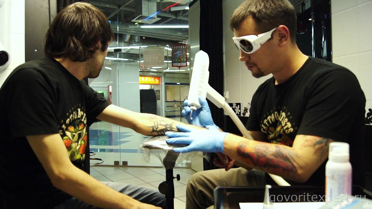 Как вывести и исправить татуировку? Говорит ЭКСПЕРТ