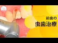 目立つところに虫歯ができてしまった‼︎前歯の虫歯治療 Tooth Decay Treatment of Front Teeth!