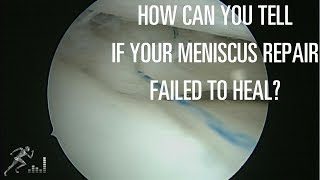 How can you tell if your meniscus repair didn