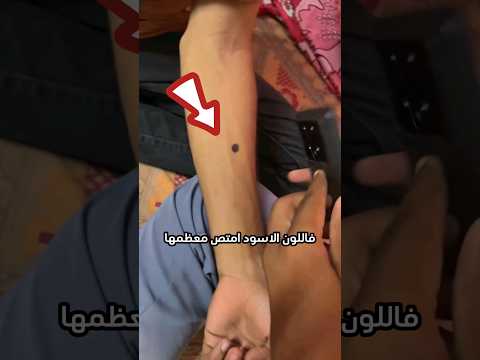 لا تضع يدك تحت فلاش الهاتف