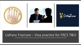 lisfranc fracture - viva practice for FRCS T&O