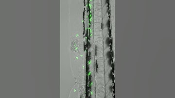 White blood cells to the rescue! Image the effects of laser injury ⚡🩸🐟 #zebrafish #biology