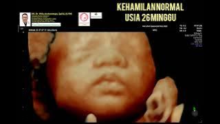 Kehamilan 26 minggu