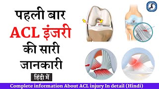 What is ACL? Complete Information in Hindi