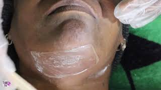 HOW TO DO A CHIN WAX! #Thanks2TRAA