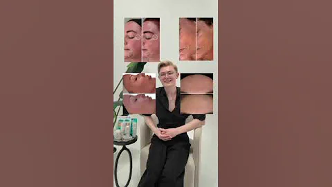 Esthetician Reviews FACTORFIVE Renew Dermal Solution | Real Corrective Skincare Results