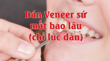 Dán veneer sứ mất bao lâu?