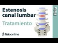 Estenosis de canal lumbar - Causas, síntomas y tratamiento