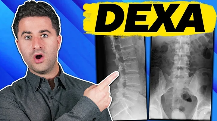 3 facts you MUST KNOW about your DEXA scan