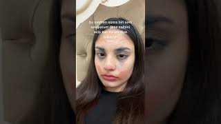 Sevenin Gonlunde Umut Olmasaa?