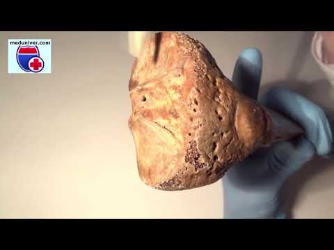Video: Schéma ženské Panvy: Anatómia, Funkcia Kostí, Svalov, Ligament