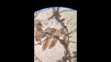 похожа на Туфельку или нет!? #испытателиприроды#микромир #микроскоп