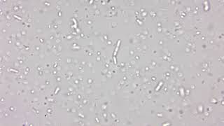 Microbial Activity in Compost Tea - 24 Hour