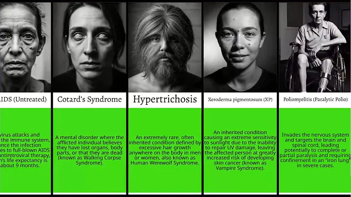 100 Rare & Disturbed Diseases That Will Haunt You