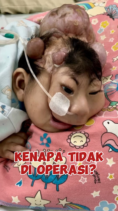 KENAPA TIDAK DI OPERASI? #bayiviral  #anugraharshaka