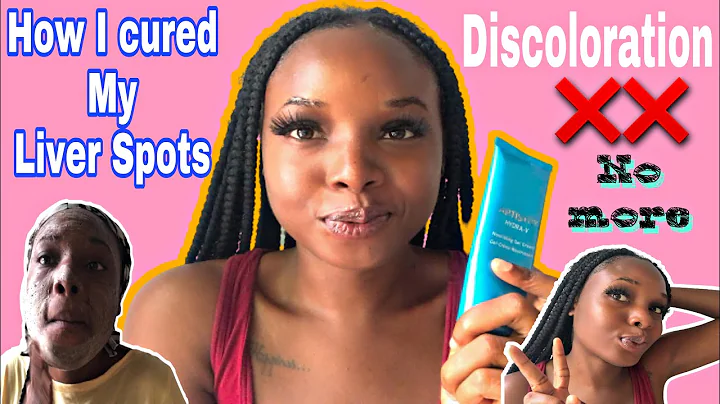 UPDATED FORMULA : How I cured my LIVER SPOTS + Pro...