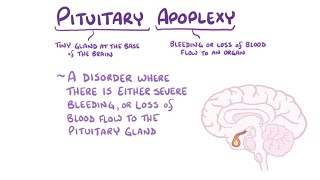 Apoplexy [Layout] By Me / Nivel Abandonado