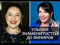 Как выглядели улыбки знаменитостей без виниров