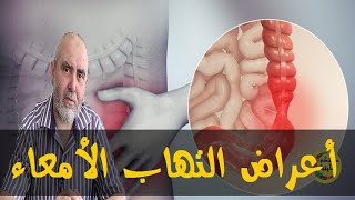 كيف أتخلص من التهاب الأمعاء بوصفات طبيعيية  - الدكتور كريم العابد العلوي -