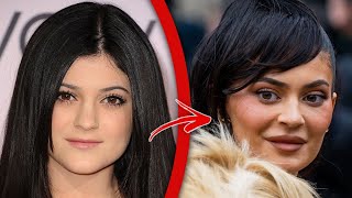 Top 10 Unrecognizable Celebrities With Botched Plastic | Doovi