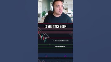 How To Get The Best Expiration Date on Options #optionstrading #optionbuying #optionsstrategy