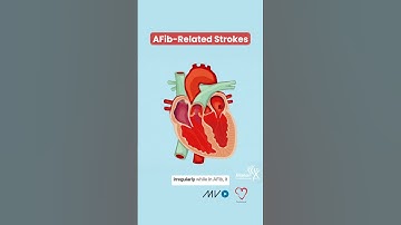 AFib-Related Strokes🫀🧠