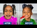 The Prince Family 😢 AYLA’S TEETH GOT WORSE! | Before &amp; After Smile Update 💔🦷  