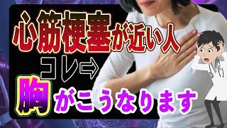 【要注意】絶対知っておいてほしい!心筋梗塞が近い人だけに起こる「胸の異変」について解説(心筋梗塞 危険なサイン)