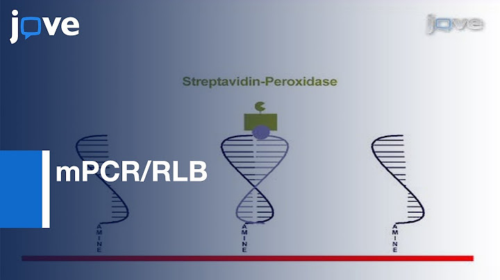 So sánh luminex analysis và reverse hybridization năm 2024