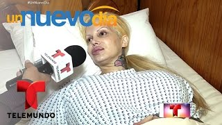 Sabrina Sabrok internada por el tamaño de sus senos | Un Nuevo Día | Telemundo