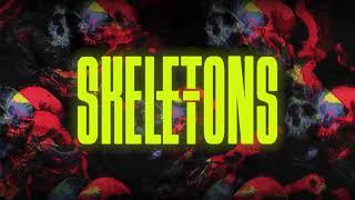 Pop Evil - Skeletons (Official Lyric Video)