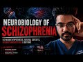 Schizophrenia part 3 - Schizophrenia: when the brain creates horror from within.💀💀