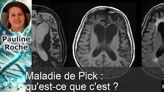 Comprendre la Maladie de Pick : Symptômes, Causes et Traitements Comprendre la Maladie de Pick : Symptômes, Causes et Traitements