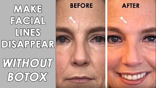 Fix Wrinkles WITHOUT Botox!
