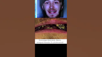Он не чистил зубы 20 лет 😨😨😨