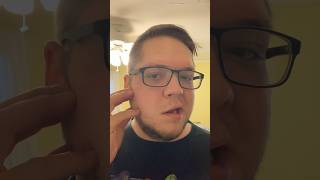 Bell’s palsy day 6 update😏