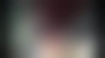 Usage of HD+ and i-scan in combination with RetroView scope - clinical images and videos