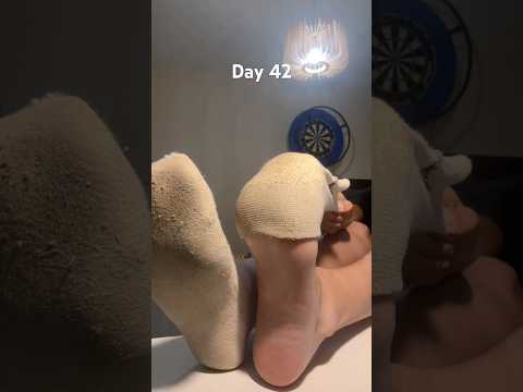 Dirty sock challenge 42