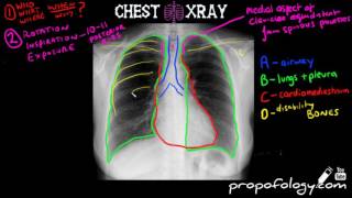 Nb: newer videos will not have music playing in the background, as per
feedback. this video is from 2018 medical finals course. comments on
older content...