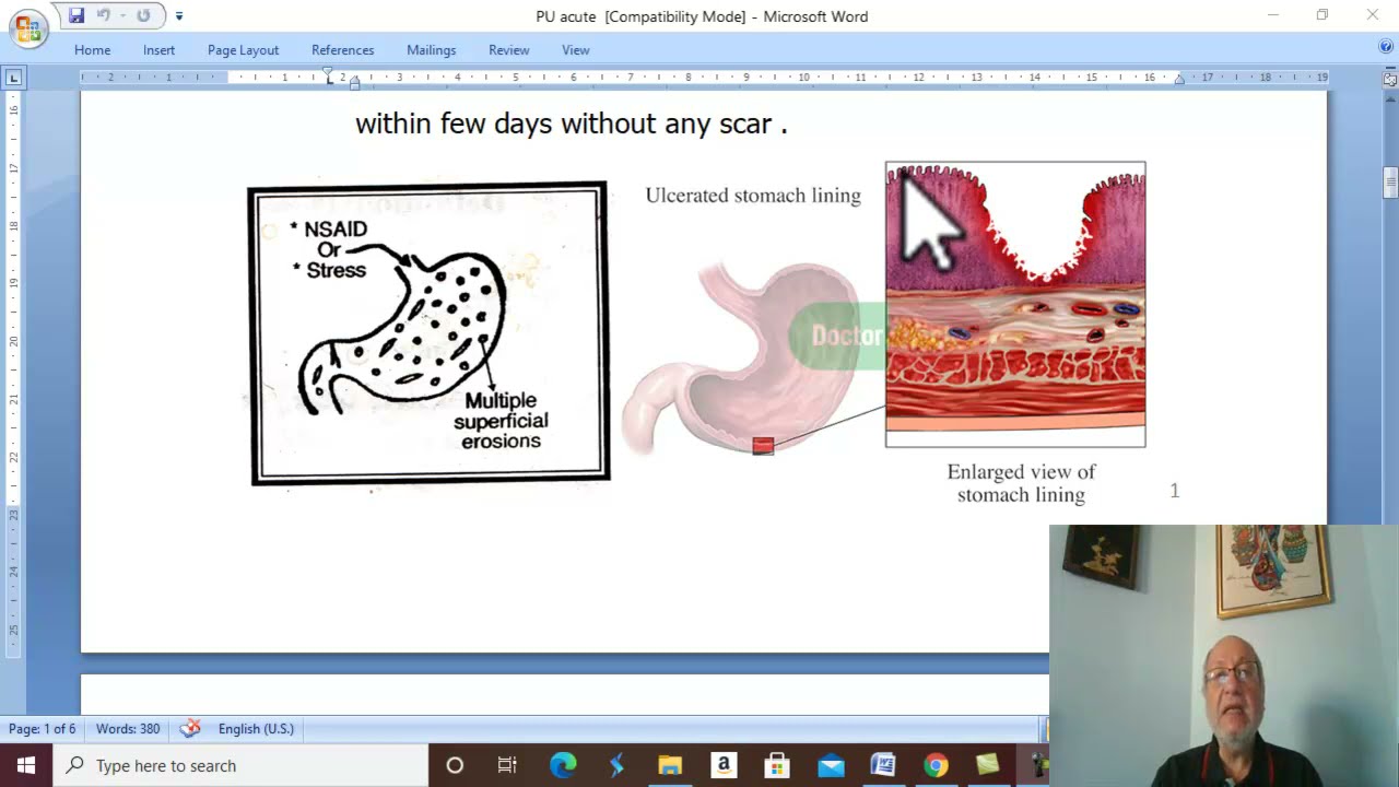 Gastric disorders in Arabic 1 ( Acute peptic ulcer ) , by Dr. Wahdan