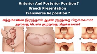 baby position in womb in tamil | fetal position |cephalic position of baby| baby position in 9 month