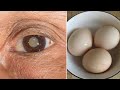 白內障、老花眼、視力模糊？雞蛋和它一起吃，視力越來越清晰，讓你恢複視力！再小的字也看得清楚！