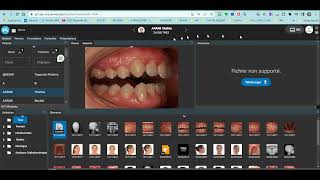 Cone Beam Under Kitview