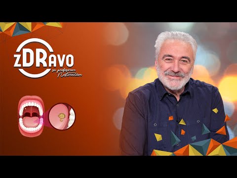 Video: Zašto je moja ranica bijela?