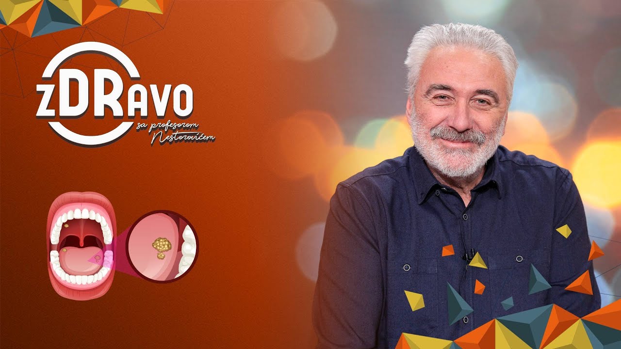 ZDRAVO SA PROFESOROM NESTOROVIĆEM – Šta usta i jezik „govore” o bolestima? Epizoda 55
