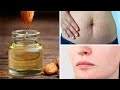 The Magic of Almond Oil for Skin